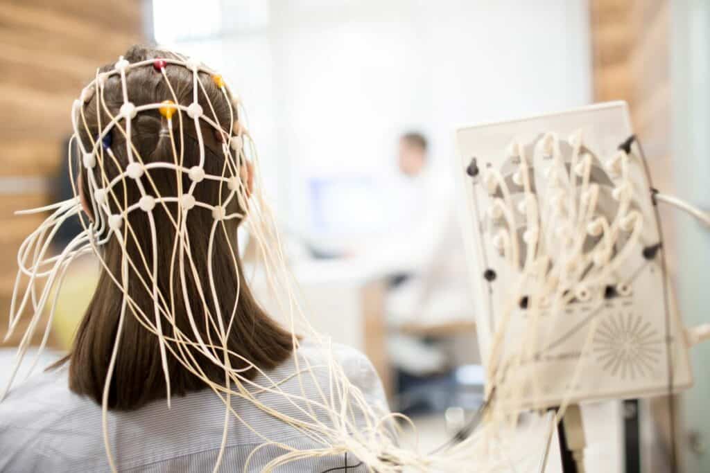 Brain stimulation
